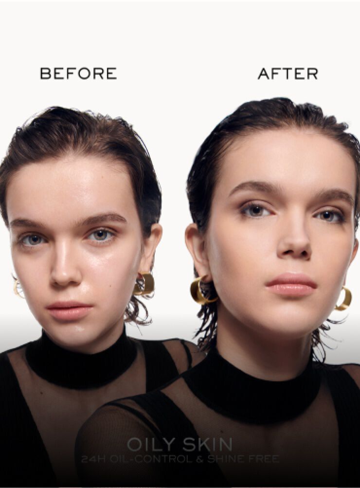 Immagine che mostra il confronto "prima" e "dopo" di una persona con pelle grassa, evidenziando il miglioramento dell’aspetto della pelle.